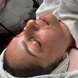 Klassische Ausreinigung