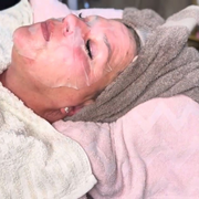 Microneedling Online Schulung -  Professionelle Hauterneuerung Schritt für Schritt