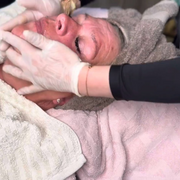 Microneedling Online Schulung -  Professionelle Hauterneuerung Schritt für Schritt